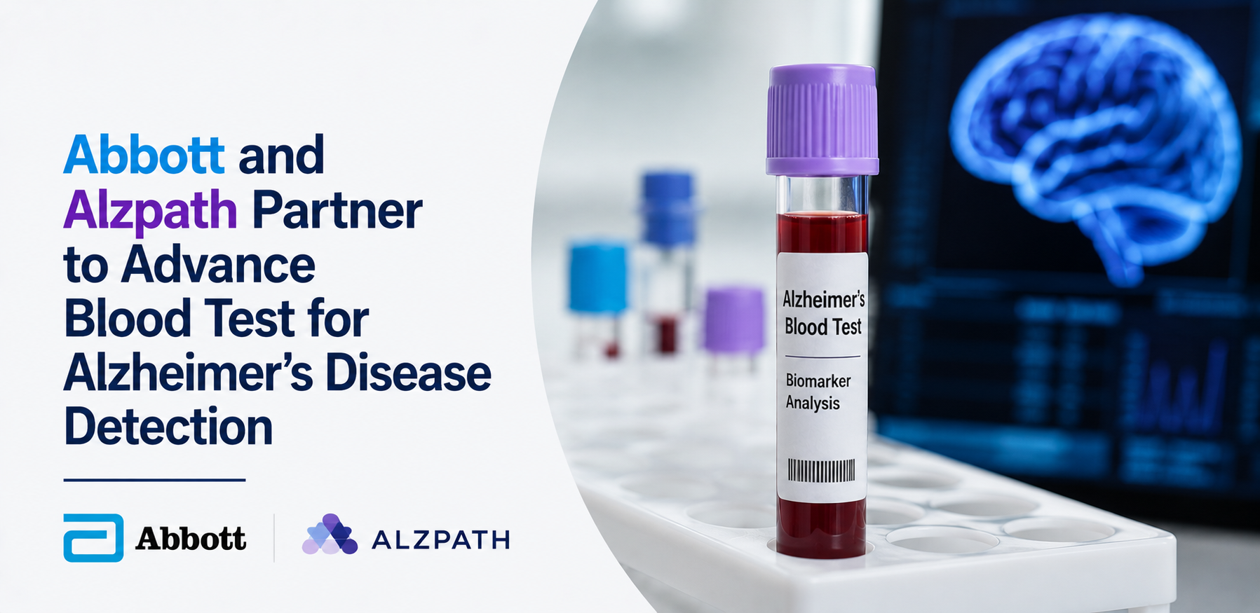 abbott and alzpath