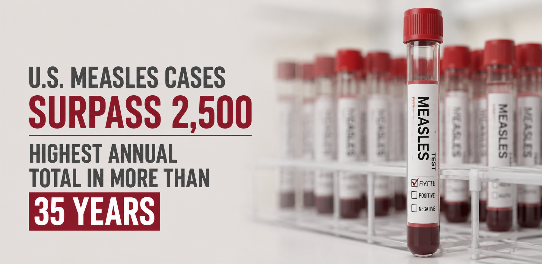 us measles cases