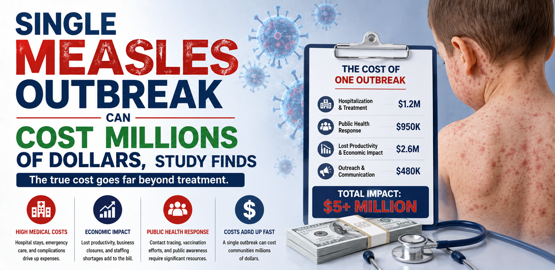 single measles outbreak