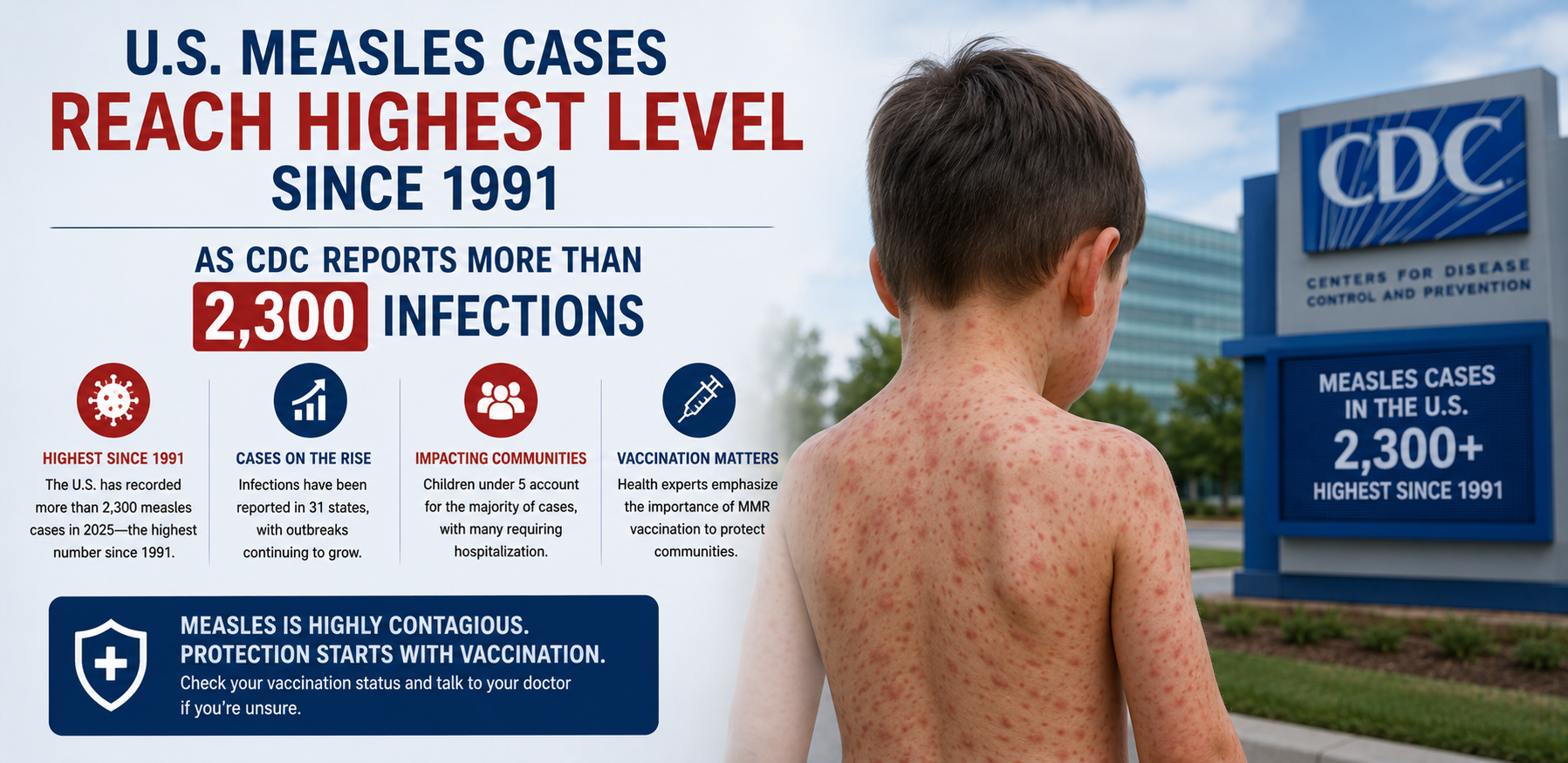usmeasles cases